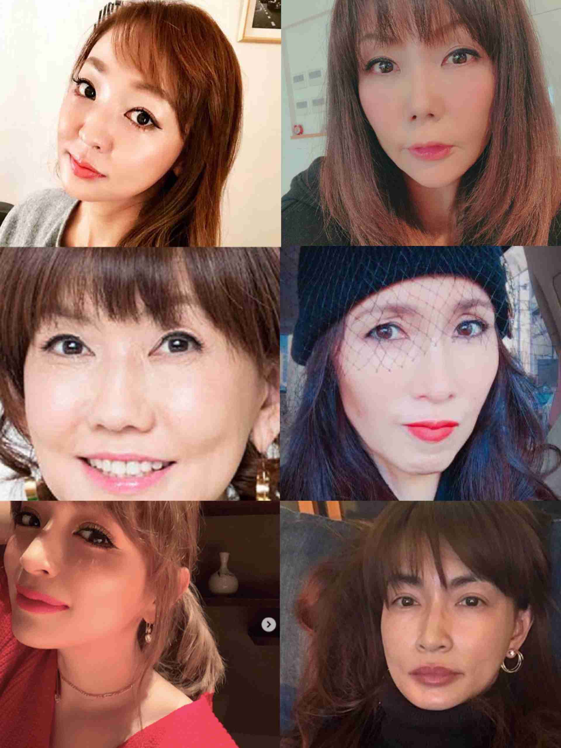 整形告白に驚いた女性芸能人10人