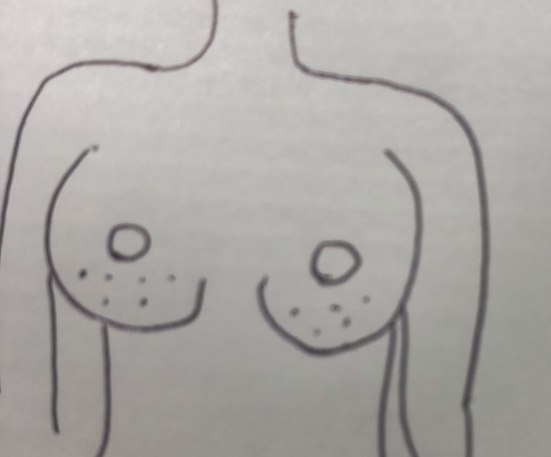 胸の悩み（貧乳、巨乳、垂れ、張りの無さ、バストトップの色、形、etc.）【part2】
