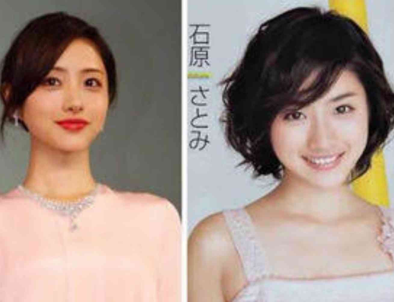 石原さとみ「整形失敗」鼻の下に違和感……新垣結衣や戸田恵梨香と同じ手術か
