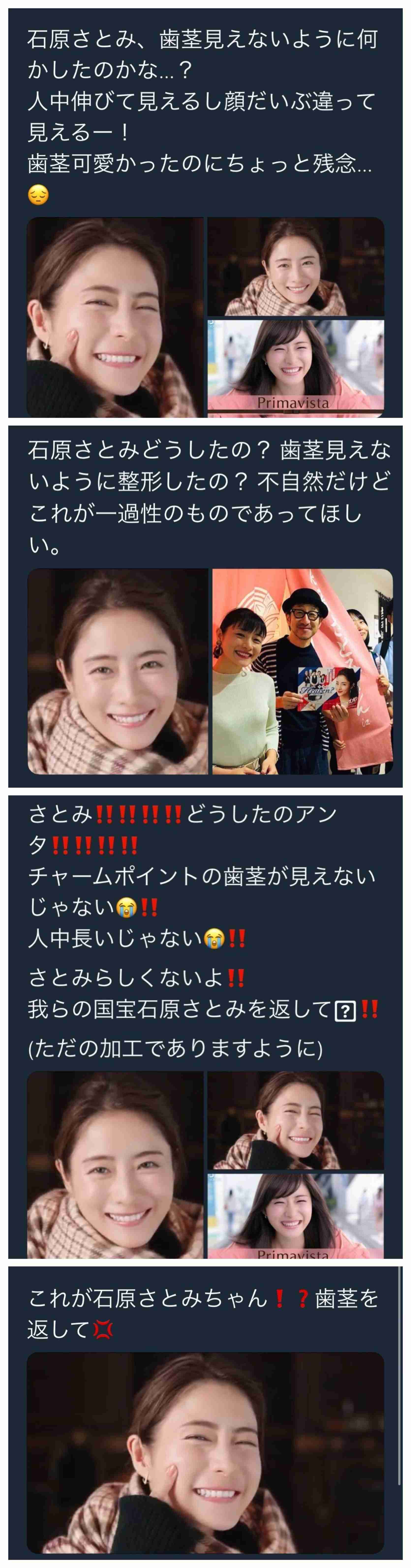 石原さとみ「整形失敗」鼻の下に違和感……新垣結衣や戸田恵梨香と同じ手術か