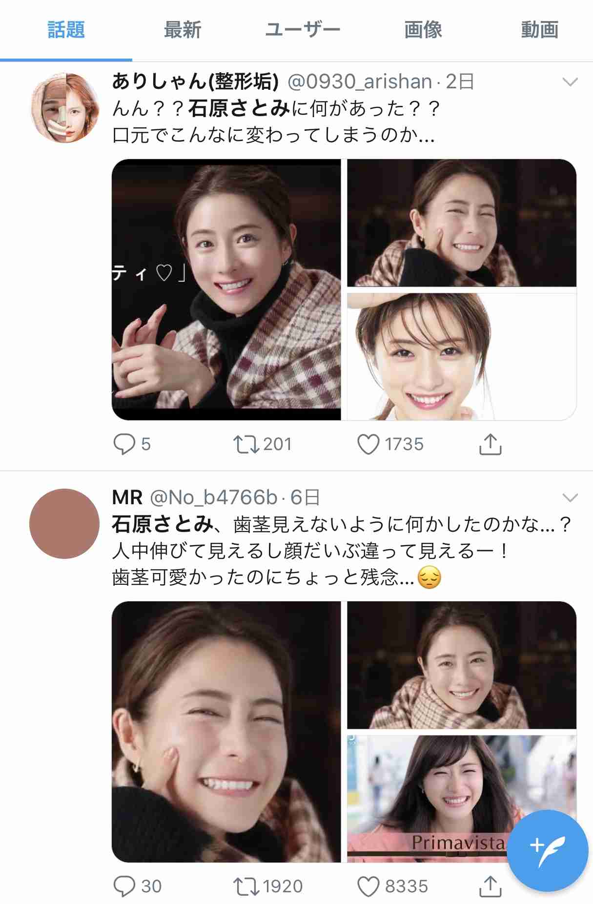 石原さとみ「整形失敗」鼻の下に違和感……新垣結衣や戸田恵梨香と同じ手術か