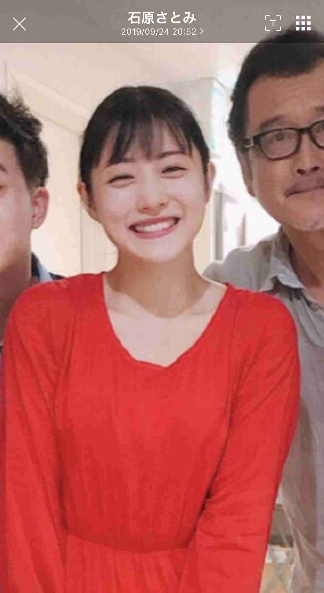 石原さとみ「整形失敗」鼻の下に違和感……新垣結衣や戸田恵梨香と同じ手術か