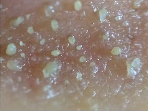 【閲覧注意】集合体が好き！