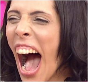 歯茎の色が悪い