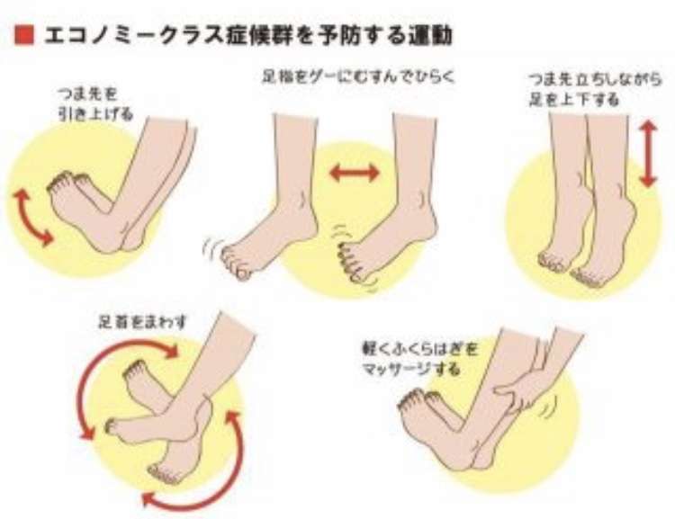 エコノミークラス症候群の予防