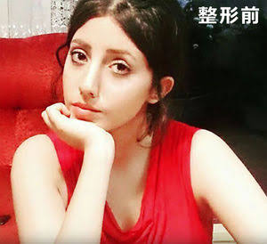 【閲覧注意】アンジェリーナ・ジョリーに憧れて50回以上の整形手術を受けた女性が逮捕