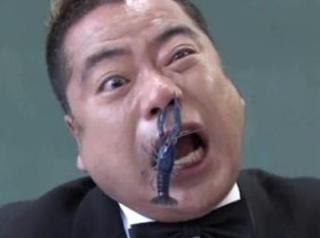 【体験談】まさか、こんな物で怪我をするとは…！