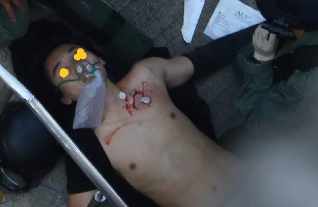 香港デモに数万人　警察が実弾を発射、負傷者も