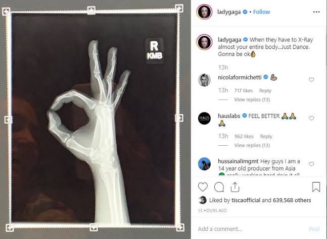 レディー・ガガ、ステージから落下　駆け上がってきたファンと戯れながら床へ