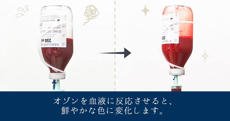 自分の老化を受け止めきれない人