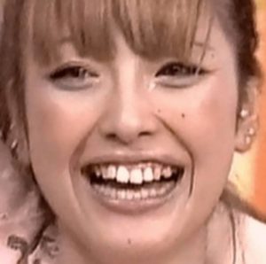 木下優樹菜、道端アンジェリカ、徳井義実…「消えた」３人の共通項