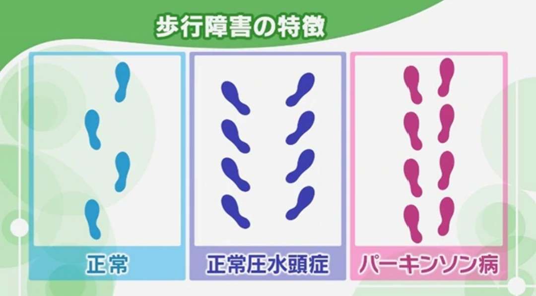 【実況・感想】ドクターX～外科医・大門未知子～　#4　テレビ朝日開局60周年記念