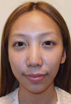 芸能人の無加工・無修正画像を貼るトピ part2