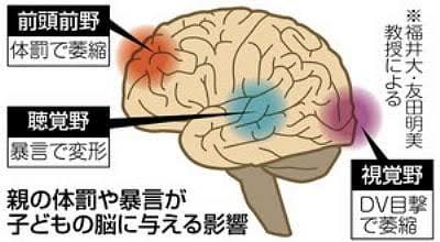 被害者遺族「どういう心境で火をつけたのか聞きたい」  京アニ放火・容疑者が転院　