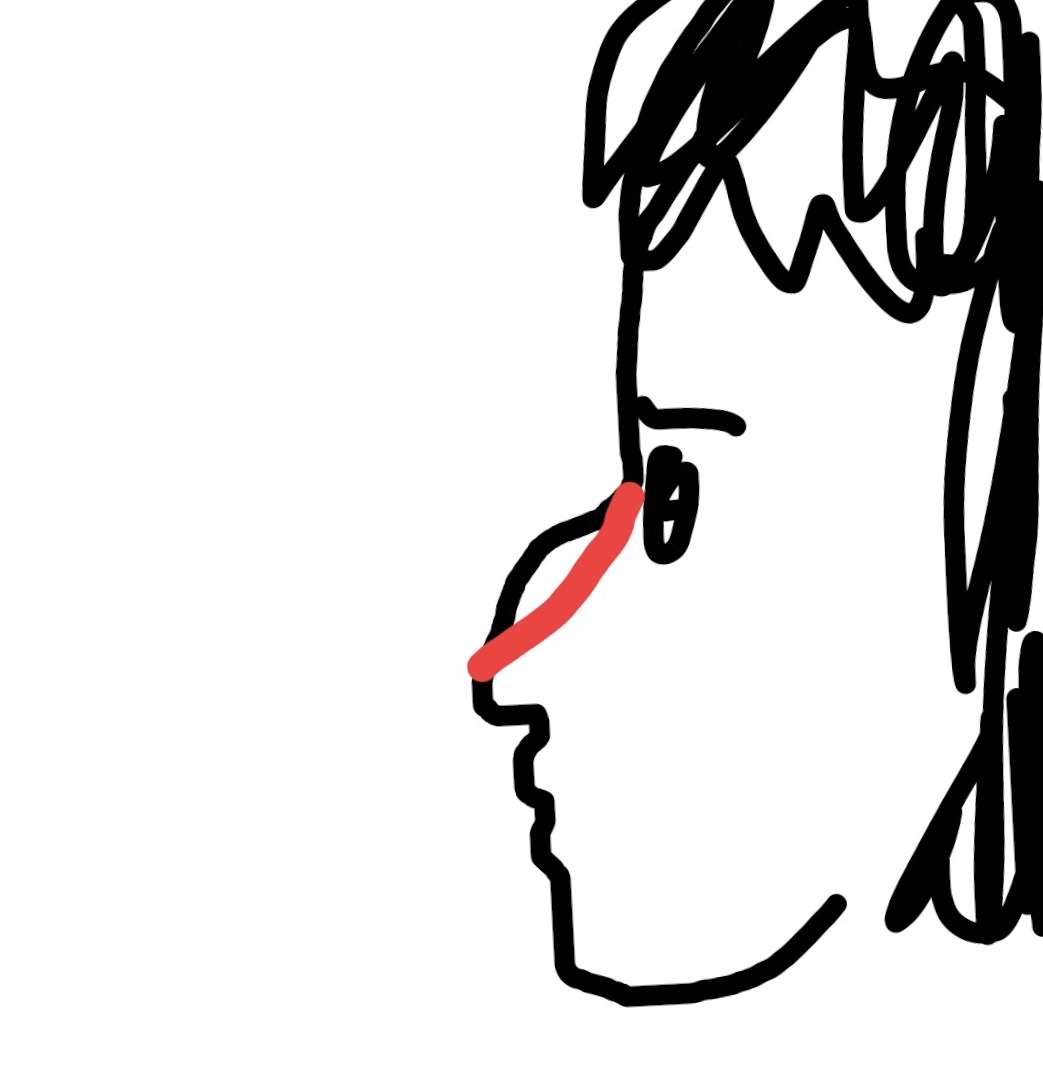 鼻が高い人の悩み