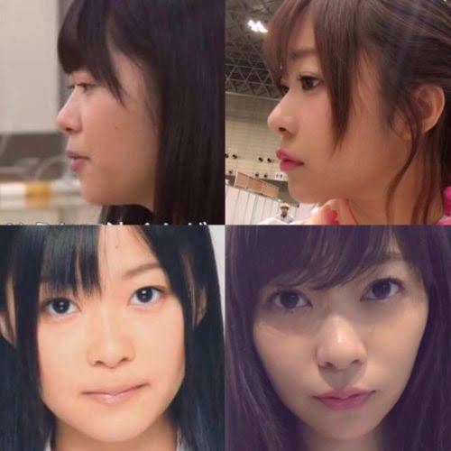 鈴木おさむ「ある女性タレントの顔が…」整形手術が“麻痺”する感覚