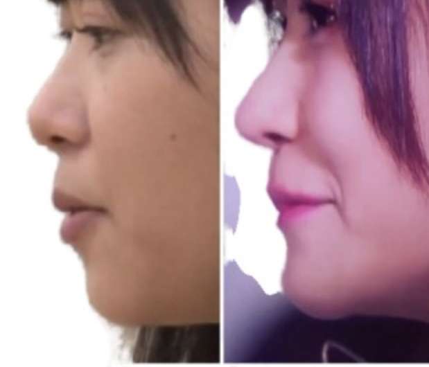 鈴木おさむ「ある女性タレントの顔が…」整形手術が“麻痺”する感覚