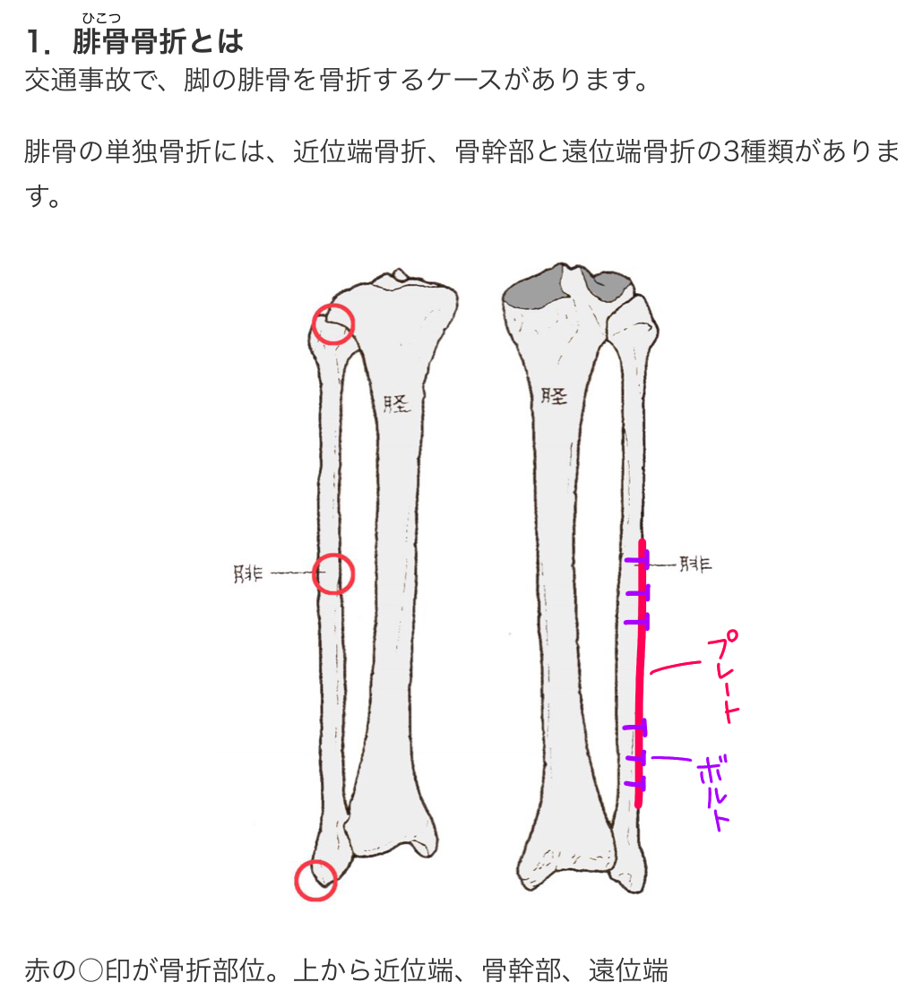 稲村亜美、骨折から1年でボルト・プレート除去手術完了「こんなの入ってたの？」と驚きの声