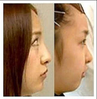 板野友美、セクシーなダンスを披露