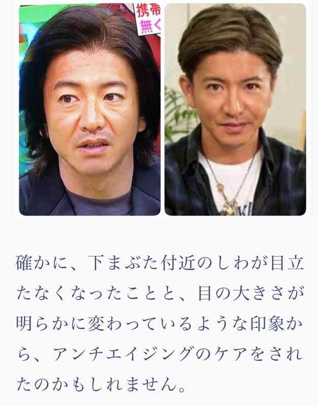 木村拓哉