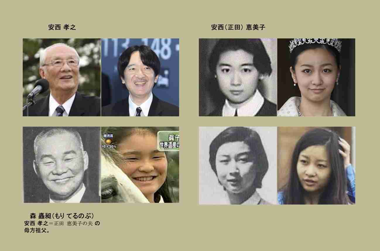 上皇后さま、血混じる嘔吐も　ストレス原因か、経過観察　宮内庁