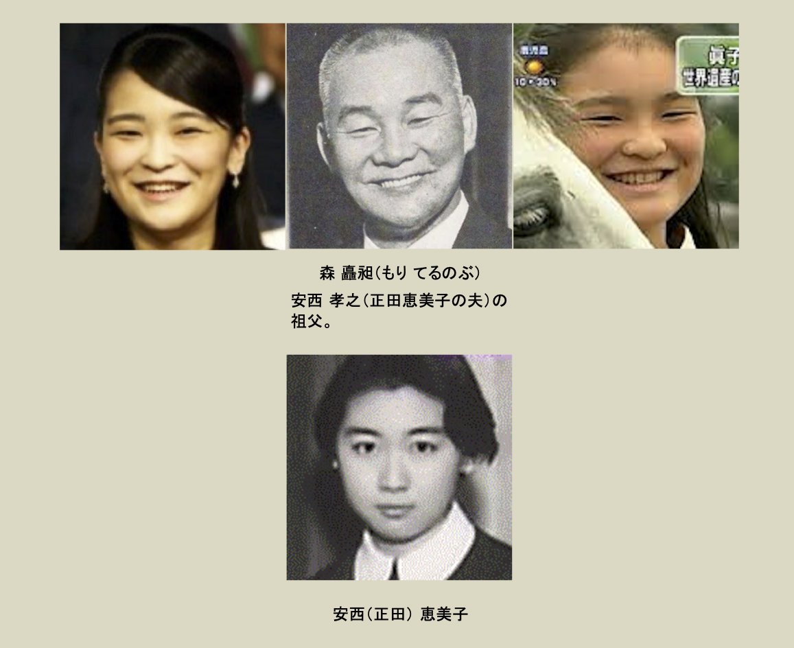 上皇后さま、血混じる嘔吐も ストレス原因か、経過観察 宮内庁