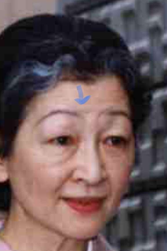 上皇后さま、血混じる嘔吐も ストレス原因か、経過観察 宮内庁