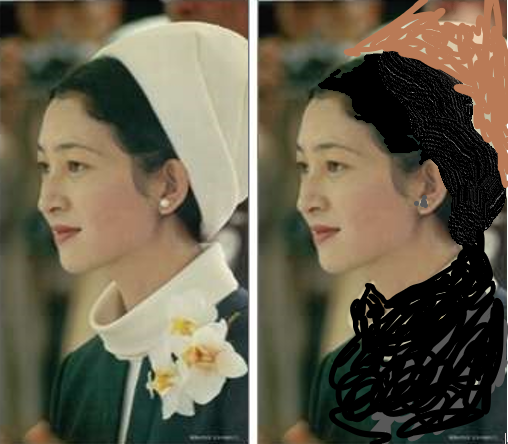 上皇后さま、血混じる嘔吐も ストレス原因か、経過観察 宮内庁