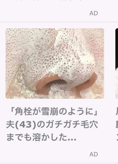 ガルちゃんに出てくる広告をスクショして貼るトピ ガールズちゃんねる Girls Channel