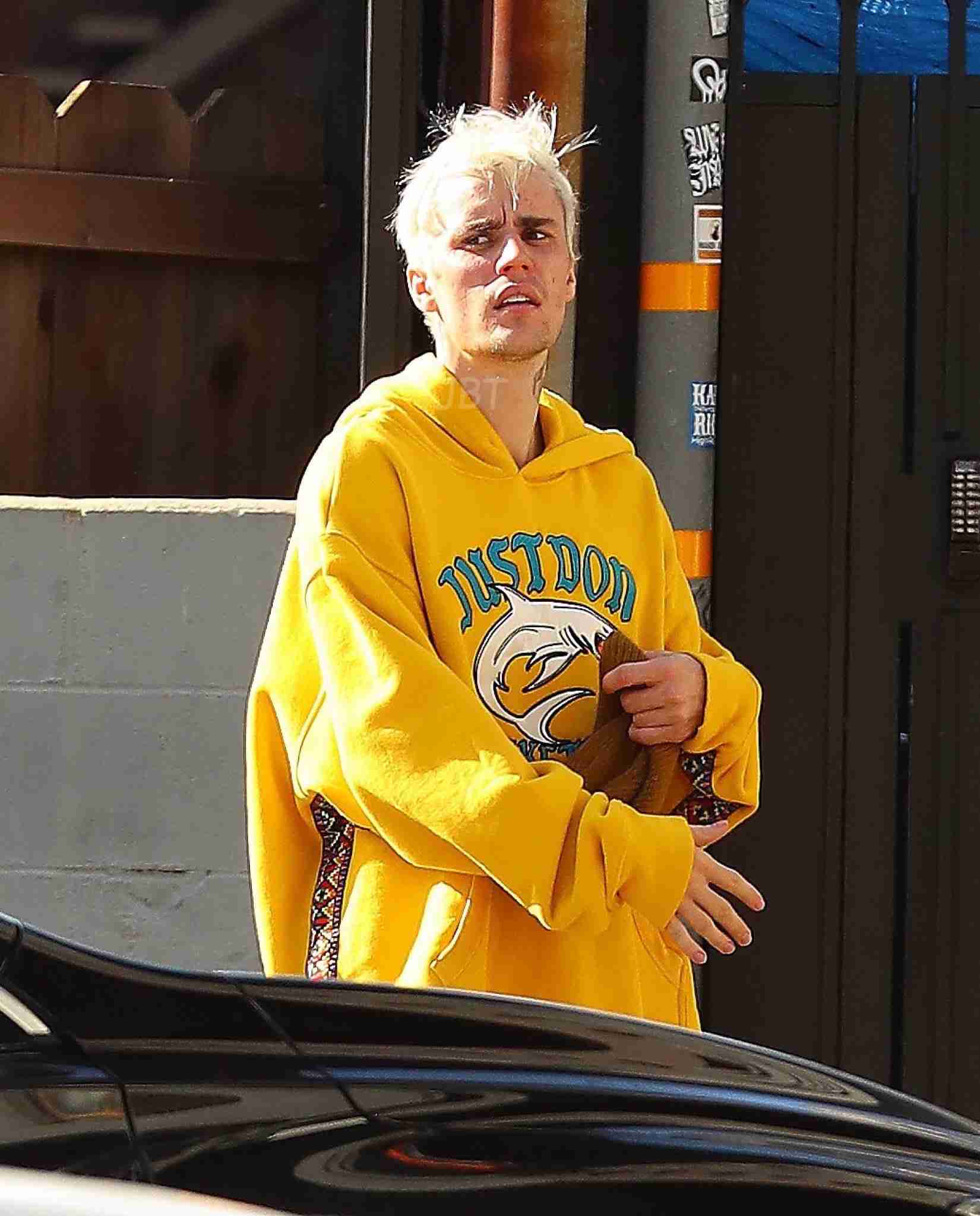 ジャスティン・ビーバー、首の新タトゥーに世間は冷ややか「いい加減やめればいいのに」