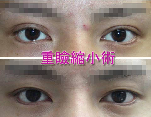 【色気】目の横幅が狭い【なし】