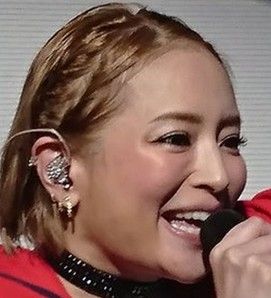 【整形トピ】顎プロテーゼについて