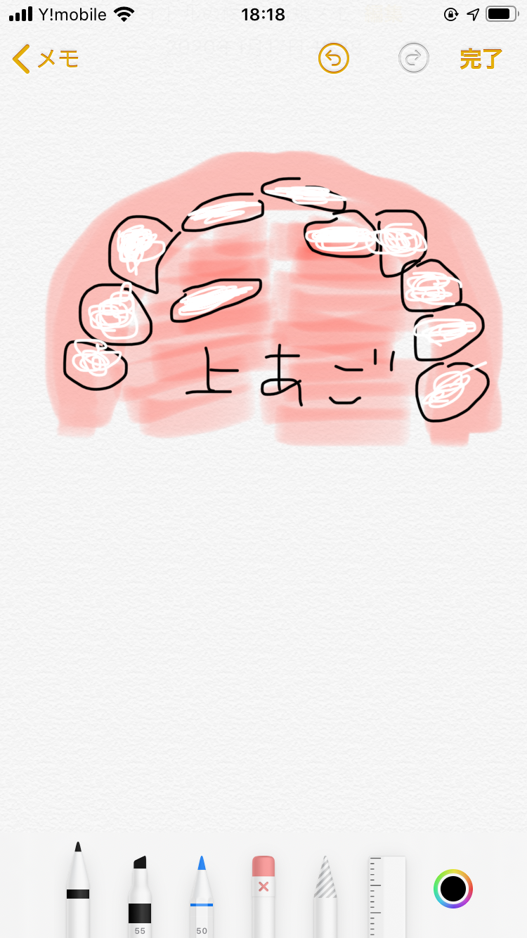 部分矯正したことある人いますか？