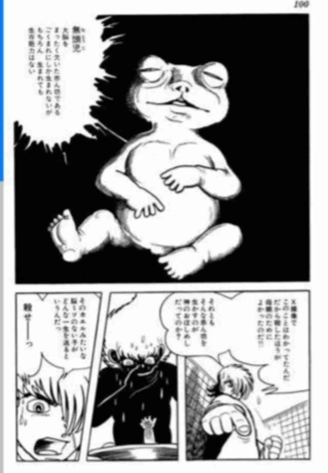 【微閲覧注意】脳がはみ出た状態で産まれた男児が1歳4か月に 母親は「絶対に生き抜く」(米)