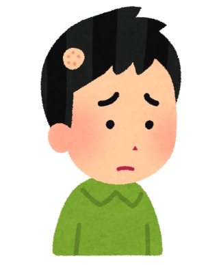 円形脱毛症の人