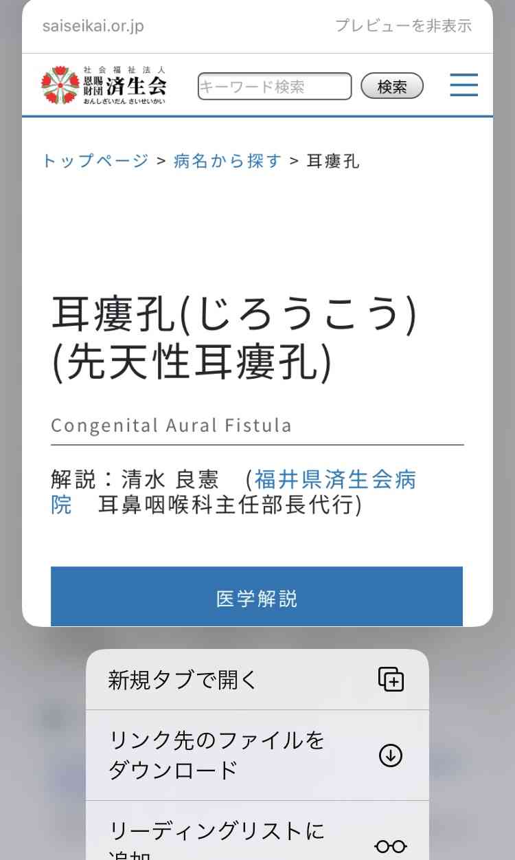 先天性耳瘻孔があるかた治療しましたか ガールズちゃんねる Girls Channel