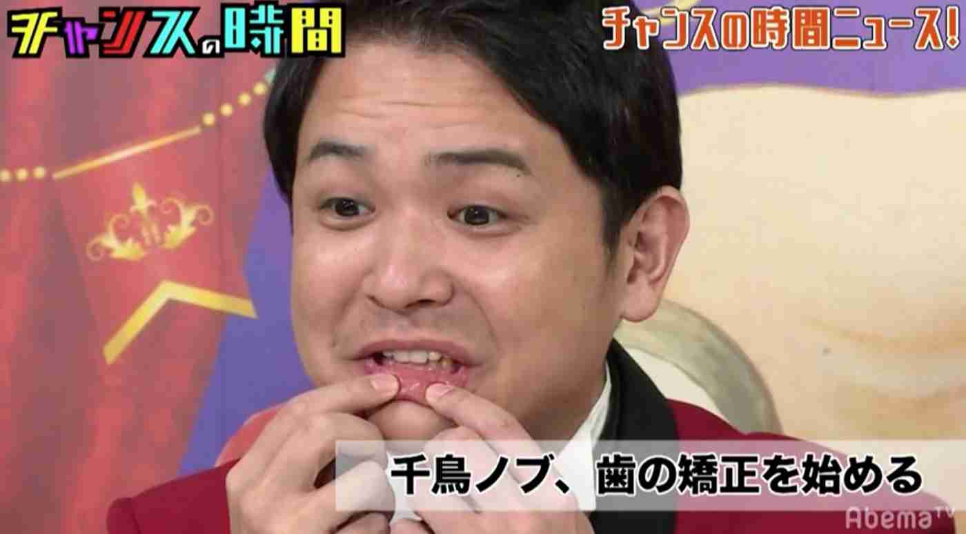 歯列矯正のビフォーアフターが見たい
