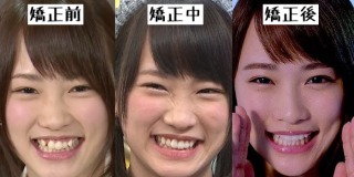 歯列矯正のビフォーアフターが見たい