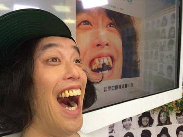 歯列矯正のビフォーアフターが見たい ガールズちゃんねる Girls Channel