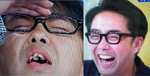歯列矯正のビフォーアフターが見たい