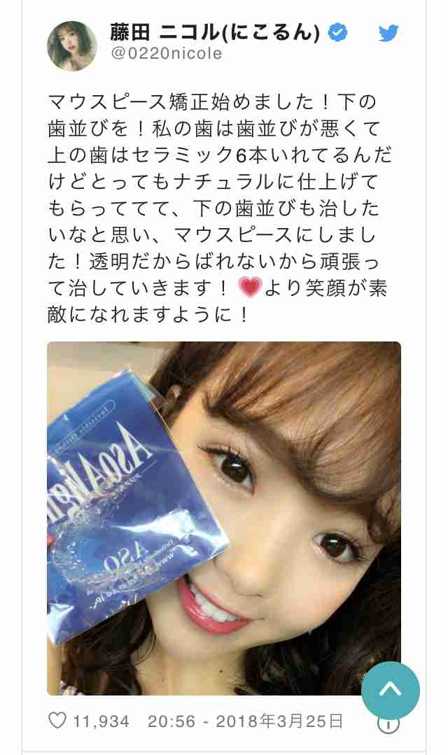 歯列矯正のビフォーアフターが見たい ガールズちゃんねる Girls Channel