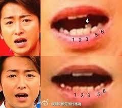 歯列矯正のビフォーアフターが見たい