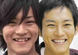 歯列矯正のビフォーアフターが見たい