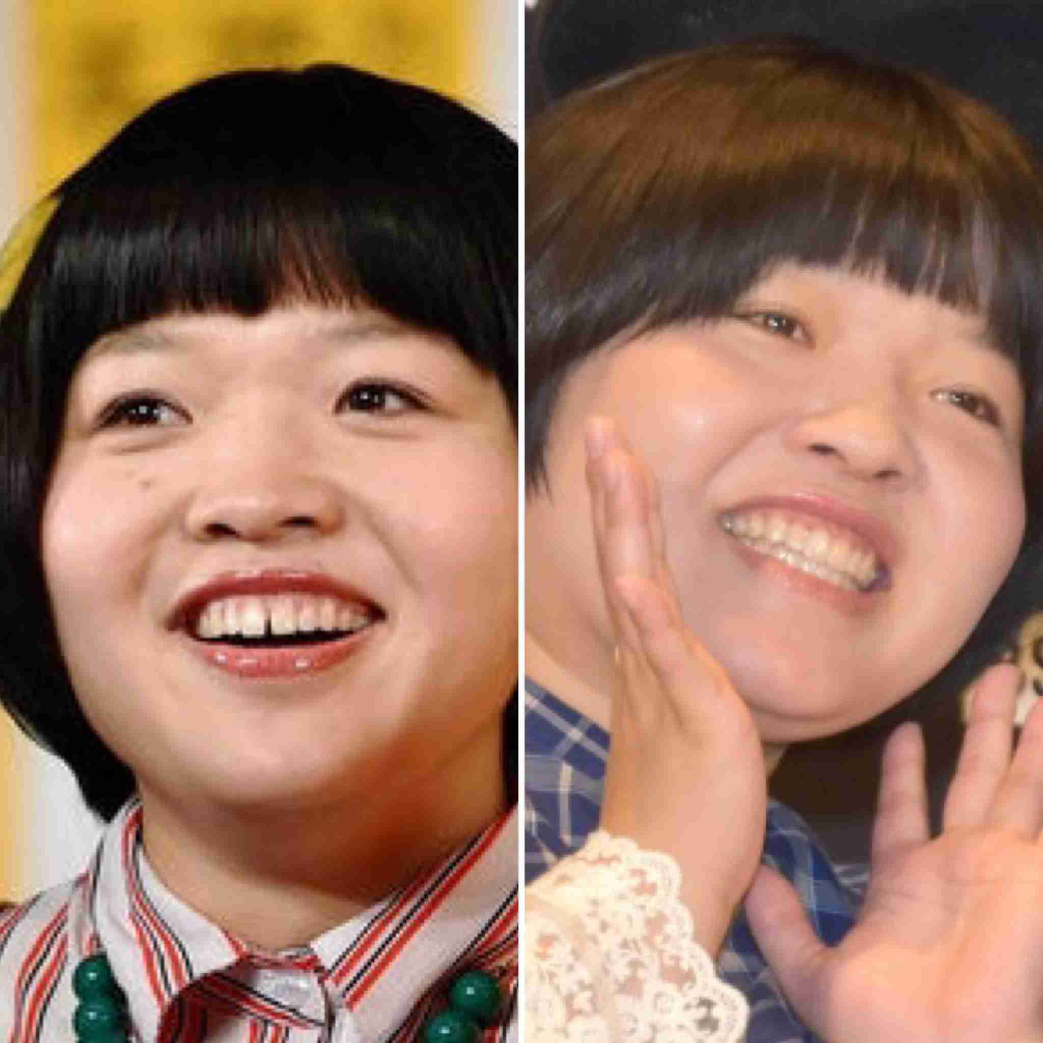 歯列矯正のビフォーアフターが見たい ガールズちゃんねる Girls Channel