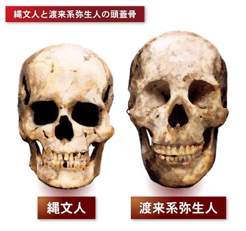 歯列矯正のビフォーアフターが見たい