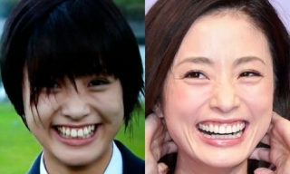 歯列矯正のビフォーアフターが見たい