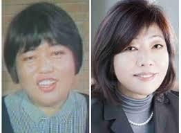 歯列矯正のビフォーアフターが見たい