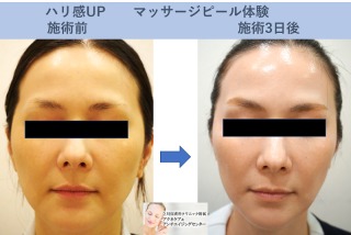 美容皮膚科に行った事ある人ー ガールズちゃんねる Girls Channel