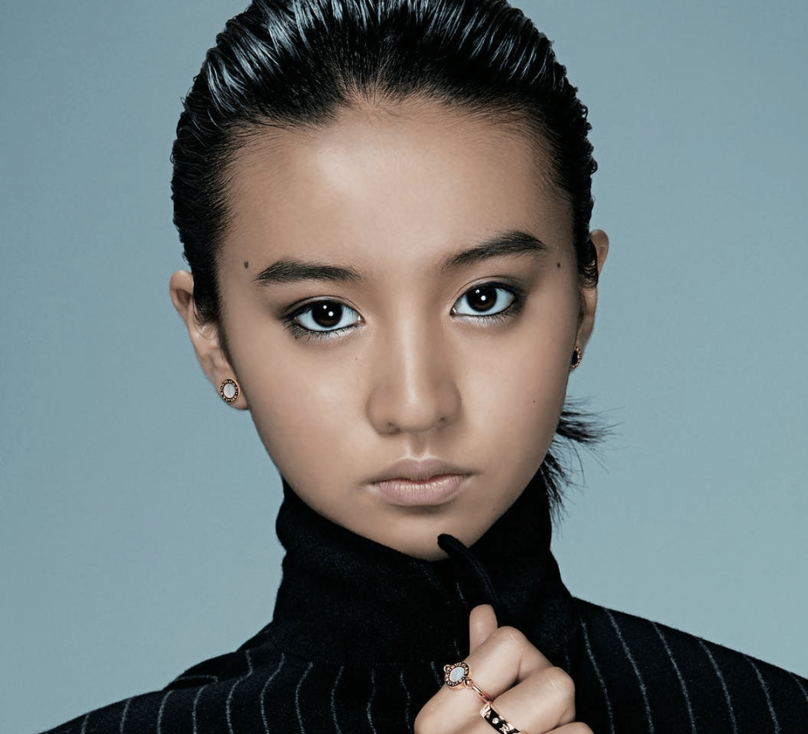 頭のハチが張ってる人 ガールズちゃんねる Girls Channel