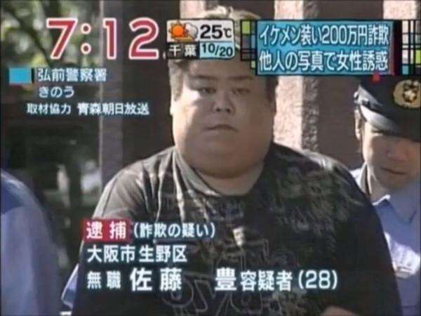 「親知らずを4本抜いた時の俺」　ヤバすぎる腫れ方に30万人の腹筋が崩壊